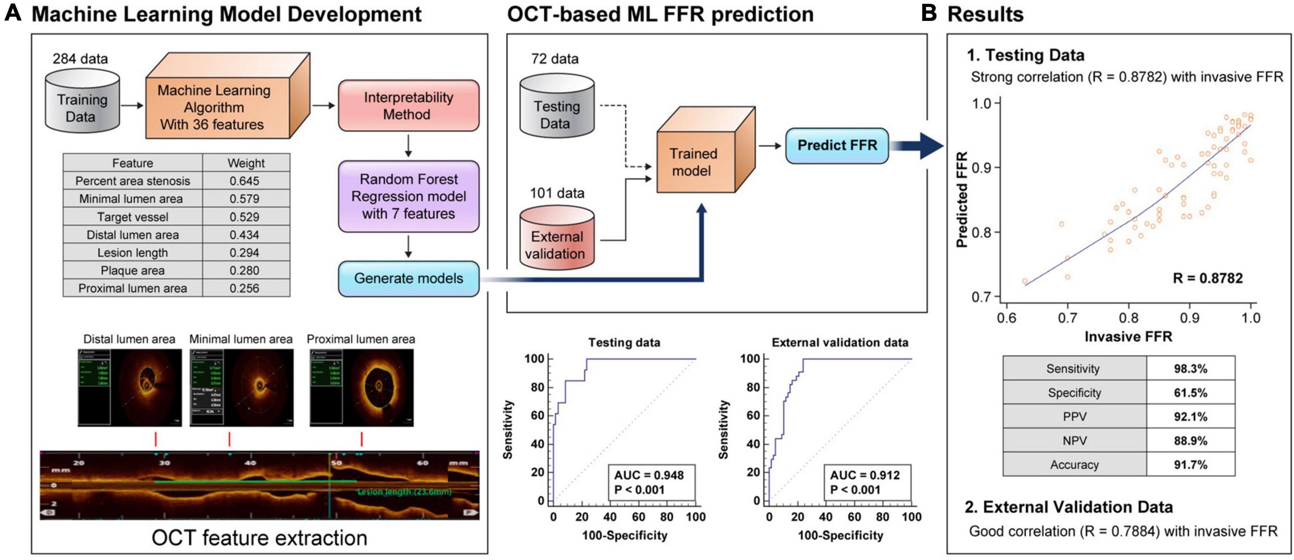 Assessment of fractional flow reserve in intermediate coronary stenosis using optical coherence tomography-based machine learning